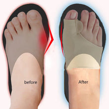 Charger l&#39;image dans la galerie, Orthèse Correctrice Hallux Valgus - Séparateur d&#39;Orteils
